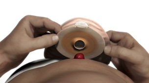 Person applying a 1 piece ostomy pouch