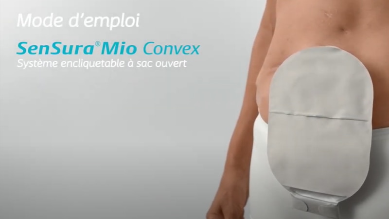 Comment utiliser le couplage mécanique SenSuraMD Mio Click – sac ouvert