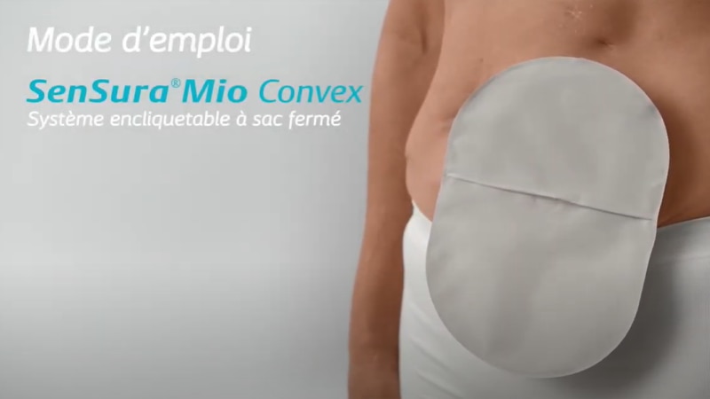 Comment utiliser le couplage mécanique SenSuraMD Mio Click – sac fermé