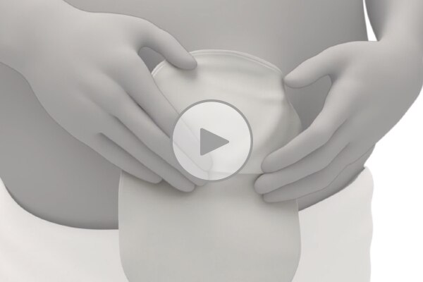 Vous avez besoin d’aide pour savoir comment utiliser SenSura® Mio Concave?