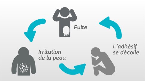 Briser le cycle de l'irritation