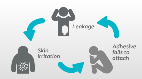 Breaking the cycle of irritation